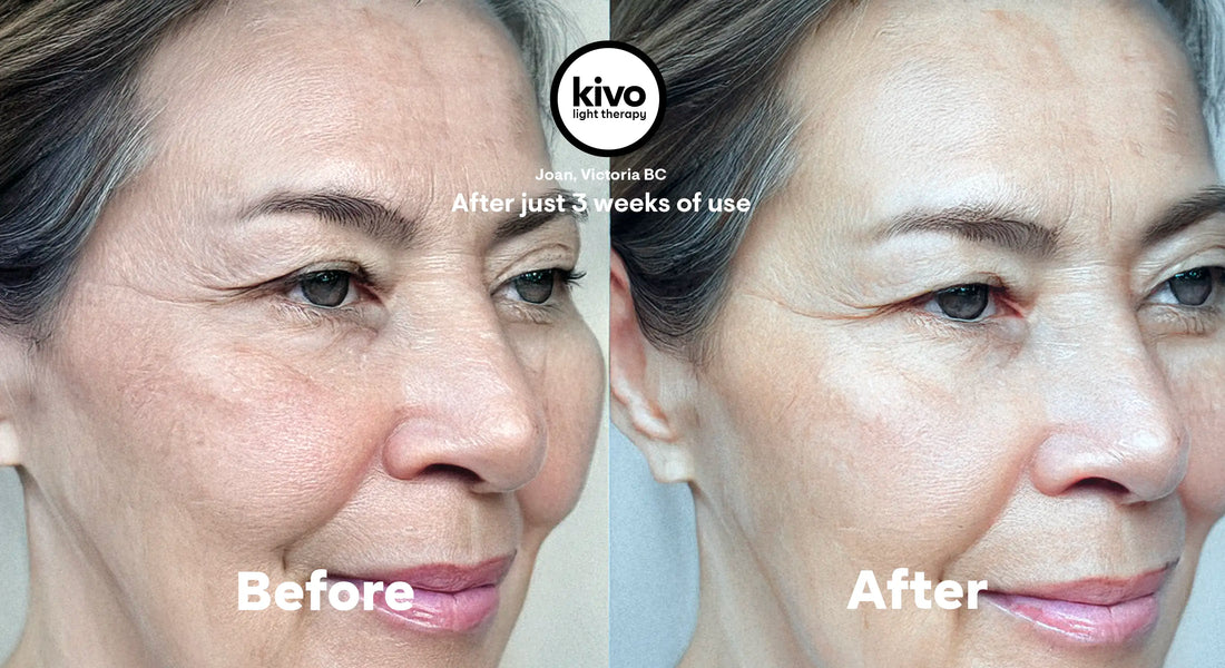 How Red Light Therapy Reduces Fine Lines and Wrinkles for Youthful Skin