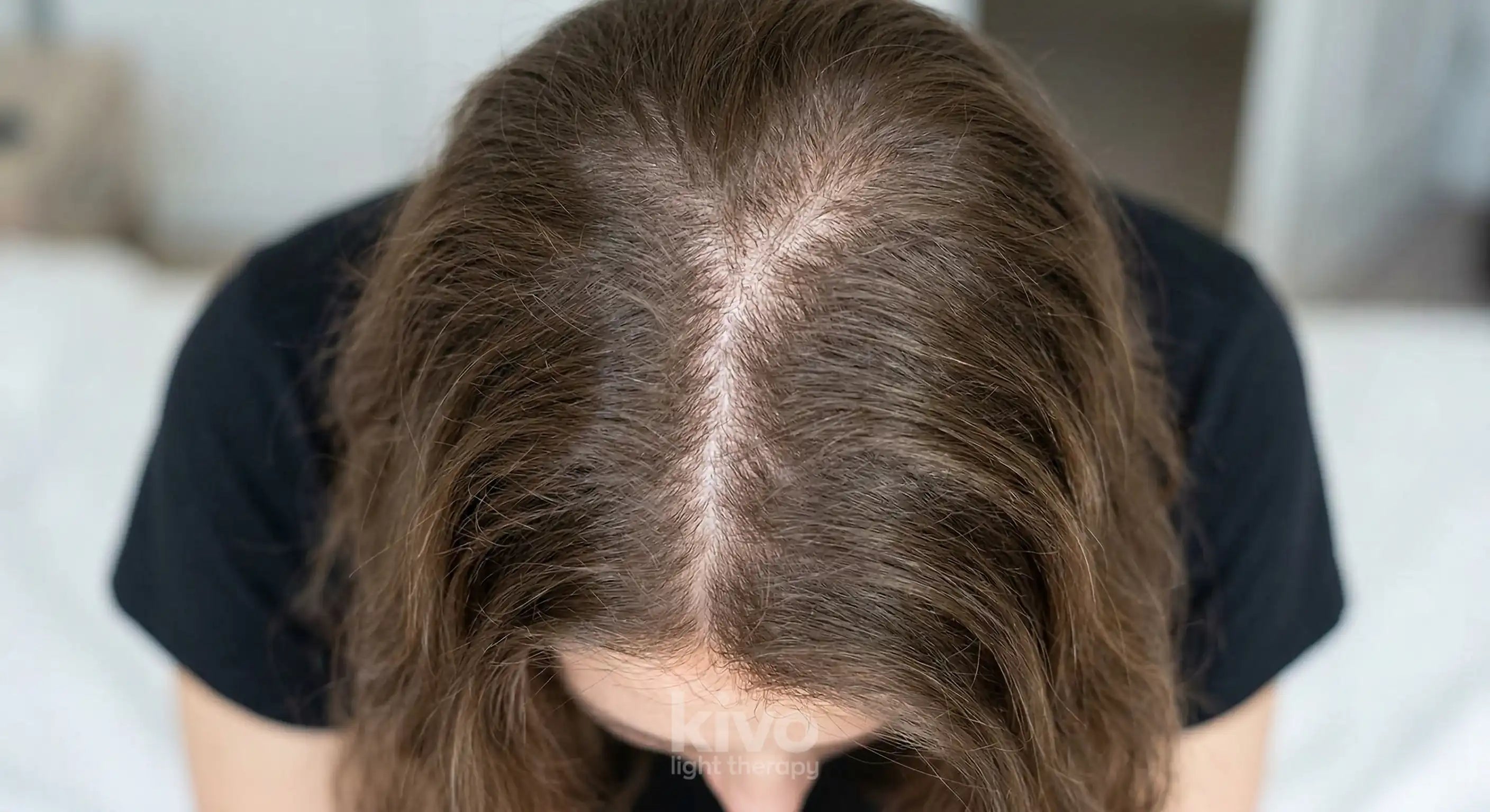 hair before led light therapy cap red